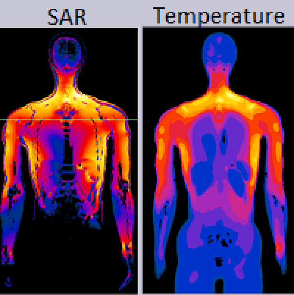 Mri System Safety Evaluation It Is Foundation