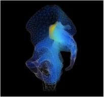 Mesh and stress distribution in a simulation of mechanical pelvic loading