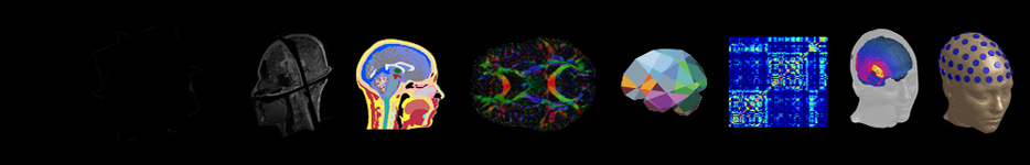 ITIS NEURO banner V1 934x150px
