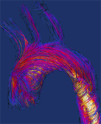 Transient 3D modeling of blood flow in the aorta with image-based geometry and boundary conditions