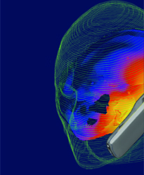 Simulation and visualization of EMF-emissions from mobile phones